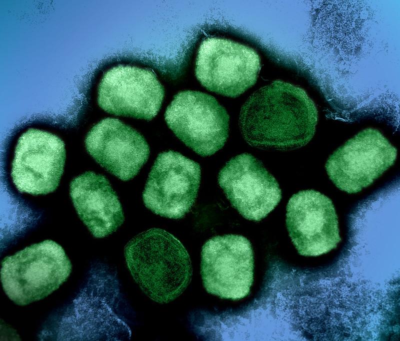 mpox virus