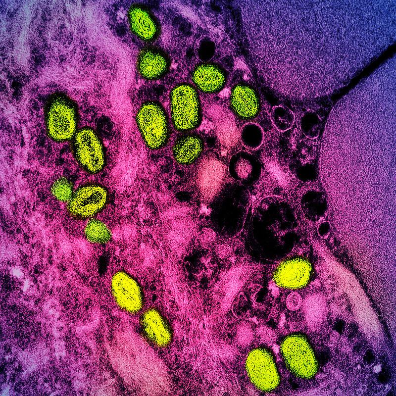 mpox green purple
