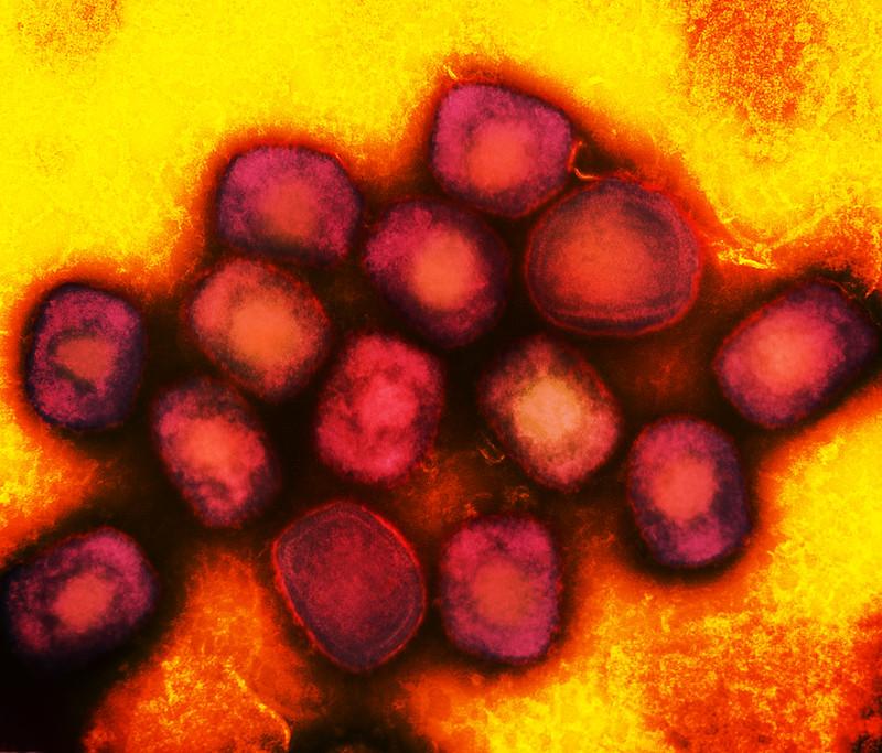 mpox maroon gold