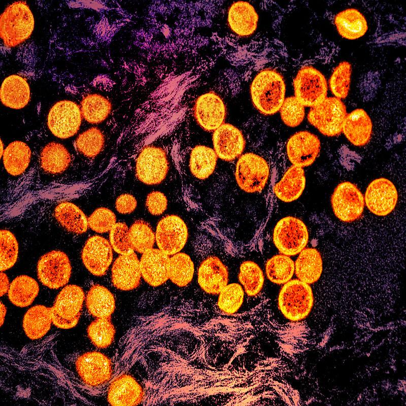 mpox purple orange