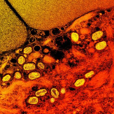 mpox virus