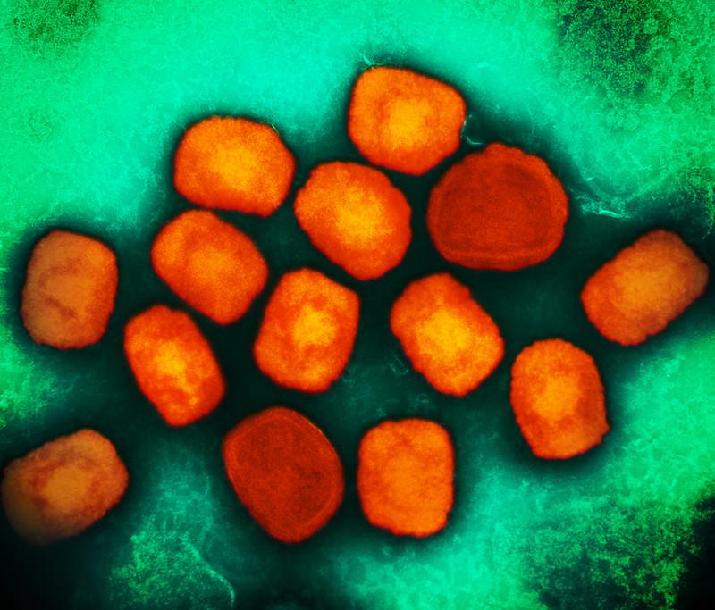 mpox virus 