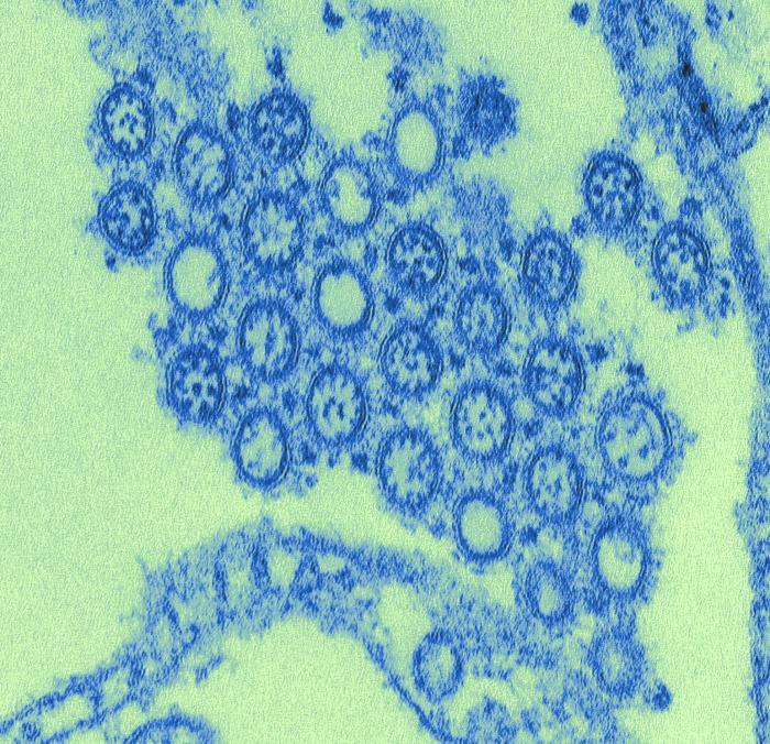 Electromicrograph of pH1N1 influenza virus