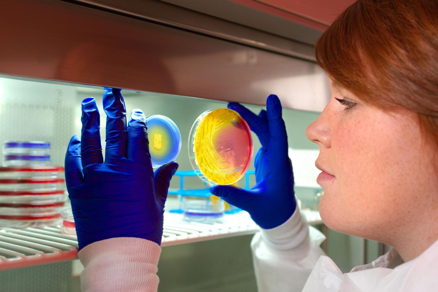 Plates inoculated with methicillin-resistant Staphylococcus aureus (MRSA) bacteria.