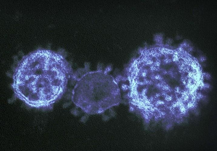 Three SARS-CoV-2 viruses
