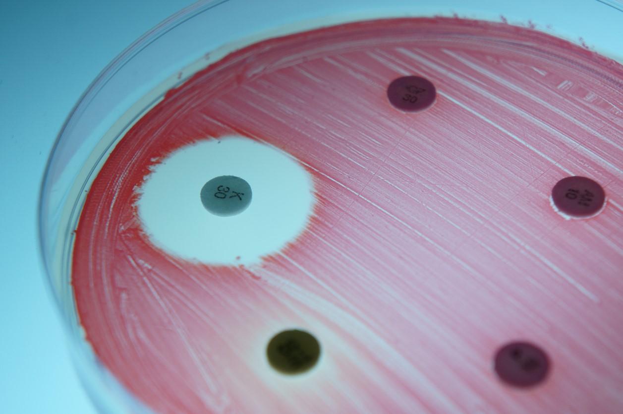 Antibiotic susceptibility test