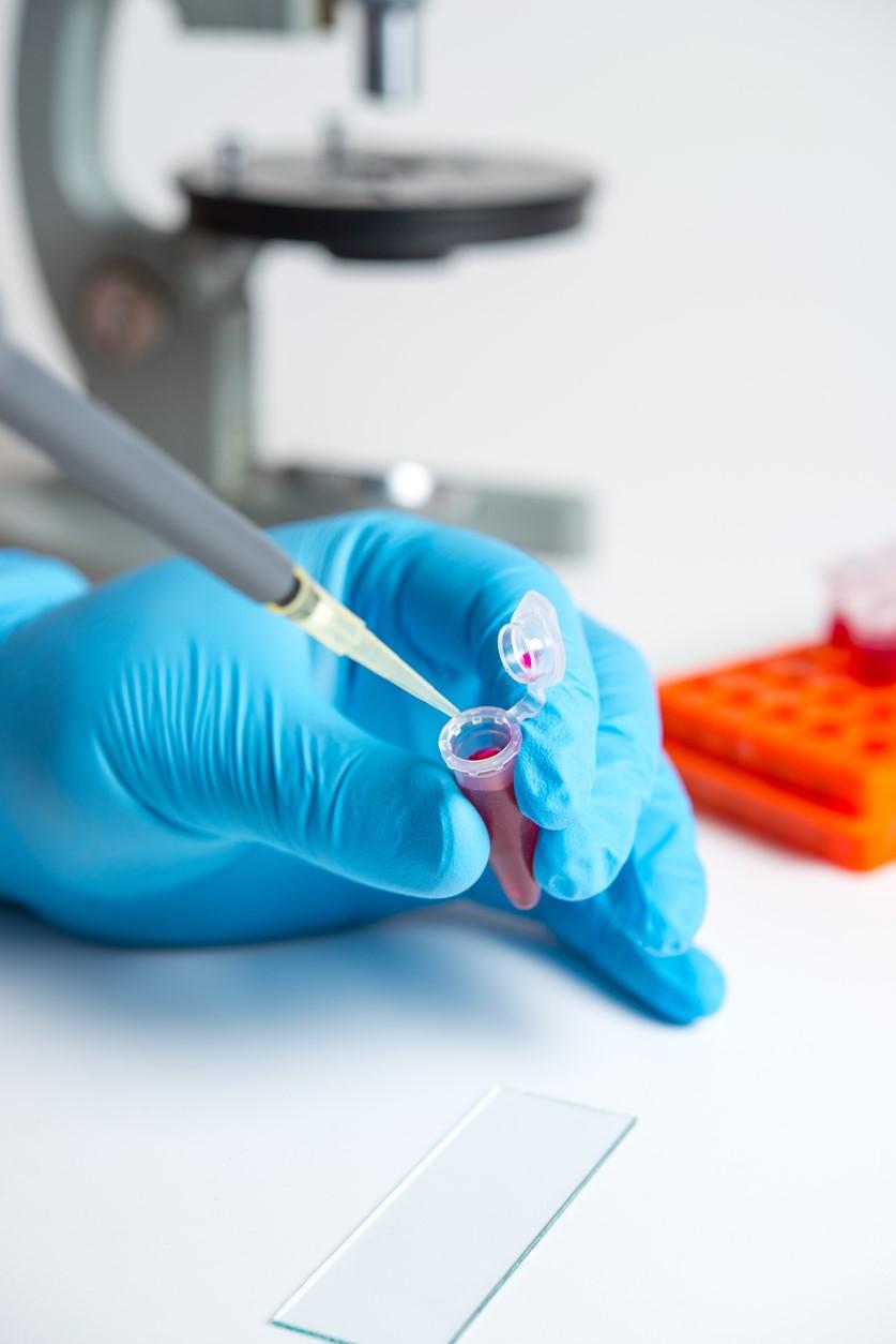 Analyzing a blood sample in a lab