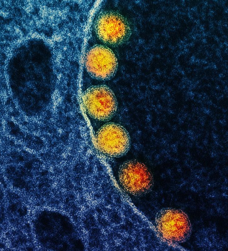 Arc of SARS-CoV-2 viruses