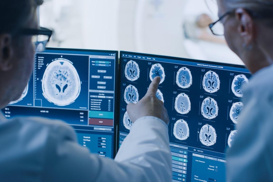Doctors assessing brain scans