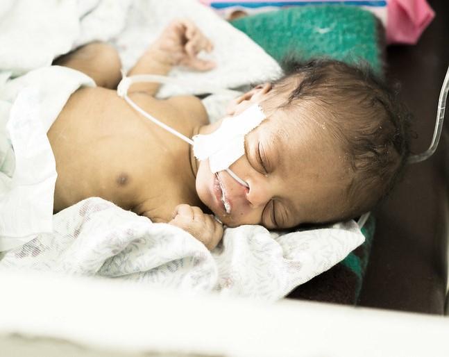 Baby being treated for sepsis