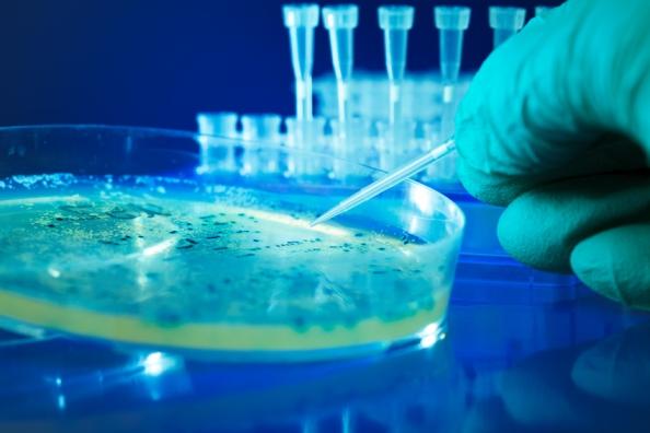 Bacteria culture in petri dish