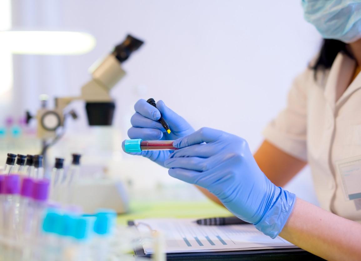 Blood sample in lab
