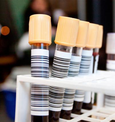 Vials of blood