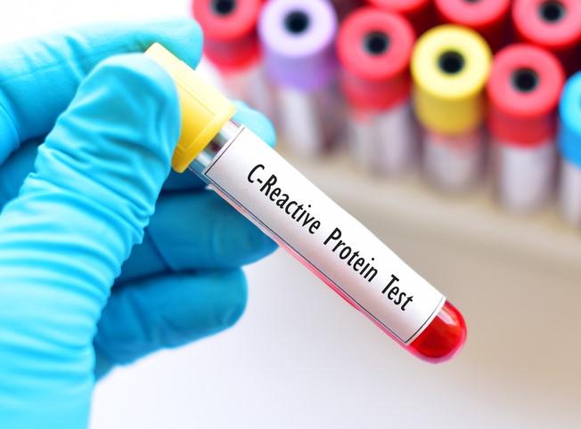 C-reactive protein test tube