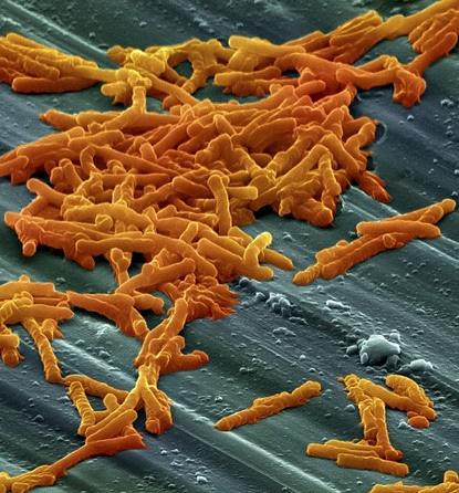 Clostridium difficile