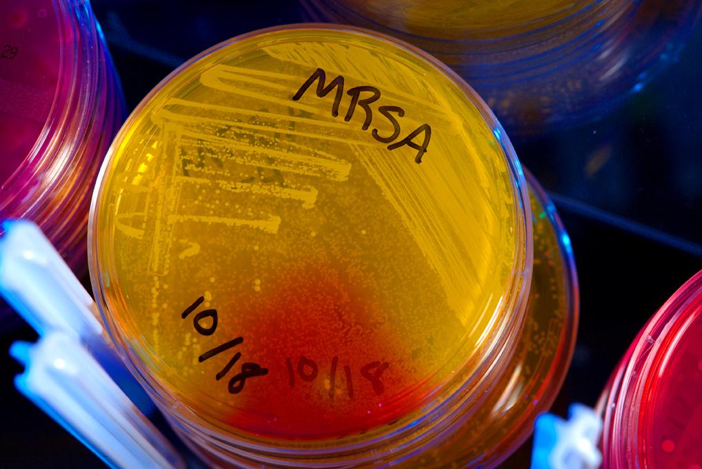 MRSA plates