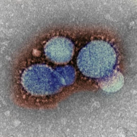 Electron microscope image of MERS-CoV