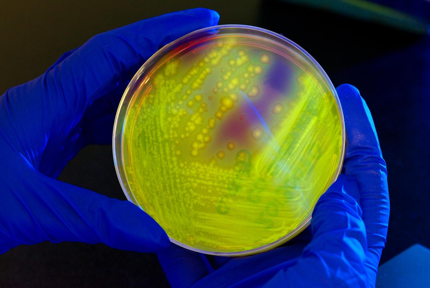 Clostridium difficile on agar plate