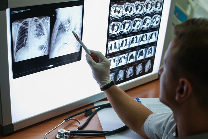 Examining chest x-rays and CT scans