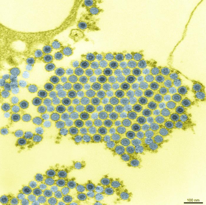 Chikungunya virus