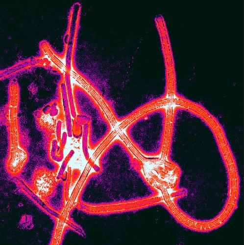 Ebola virus
