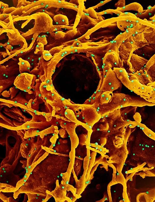 Colorized microscope image of SARS-CoV-2