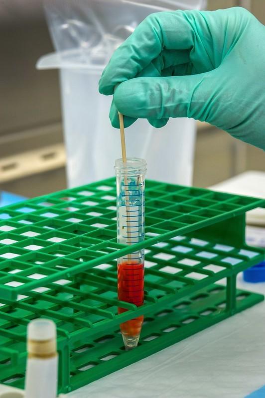 COVID-19 lab testing