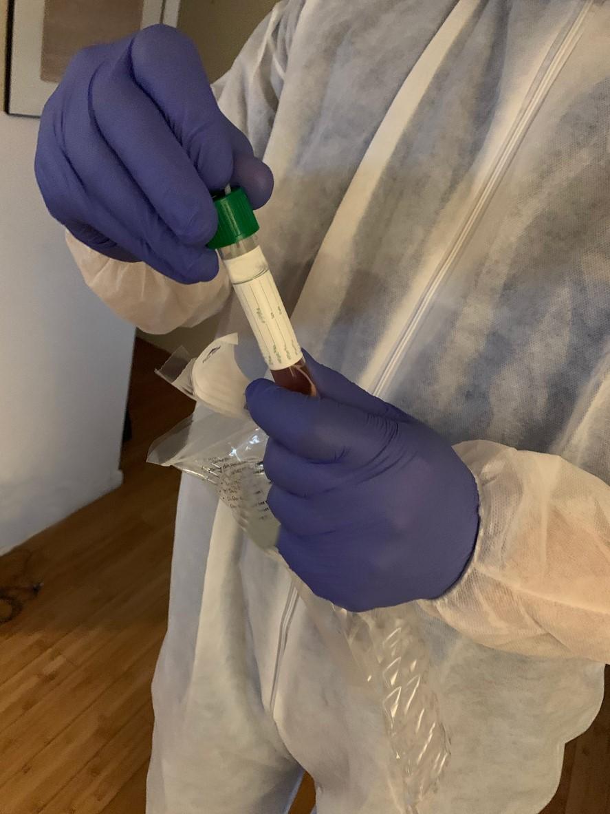 COVID-19 testing vial