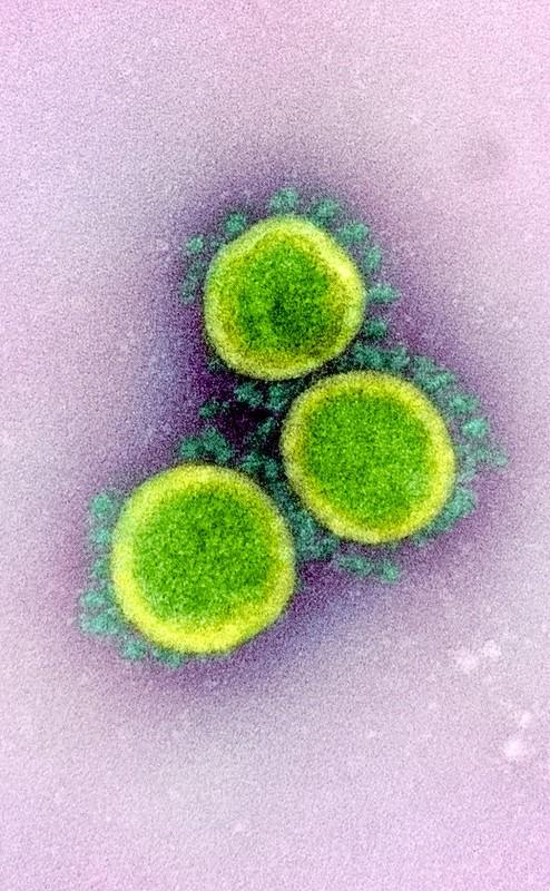 COVID-19 viruses