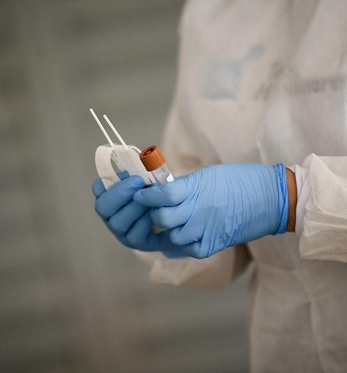 COVID molecular test