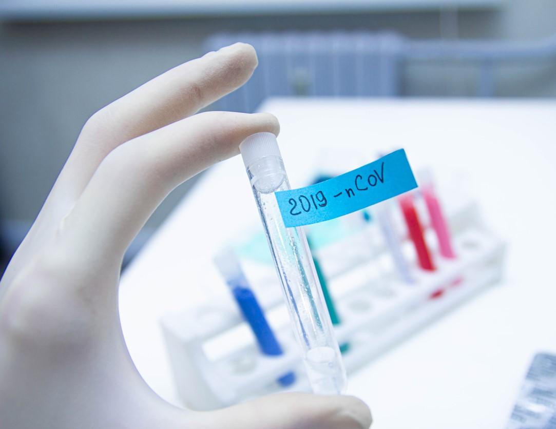COVID-19 test tube