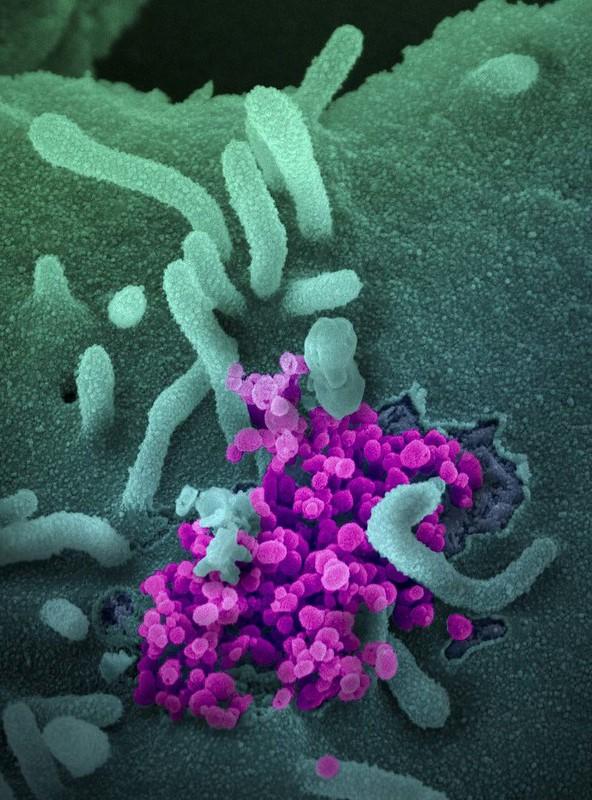 SARS-CoV-2 virus under microscope