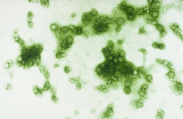 Dengue virus