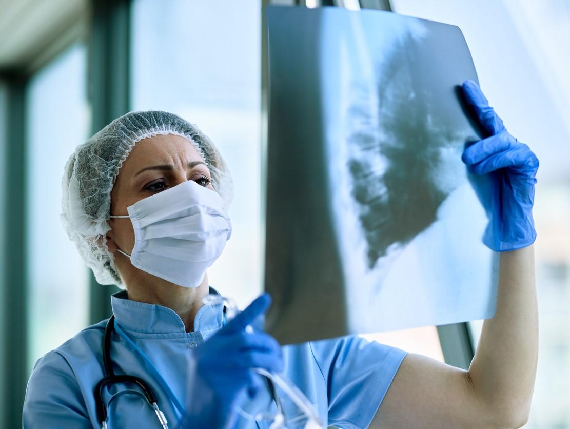 Doctor examining chest x-ray