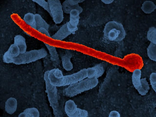 Ebola Makona virus