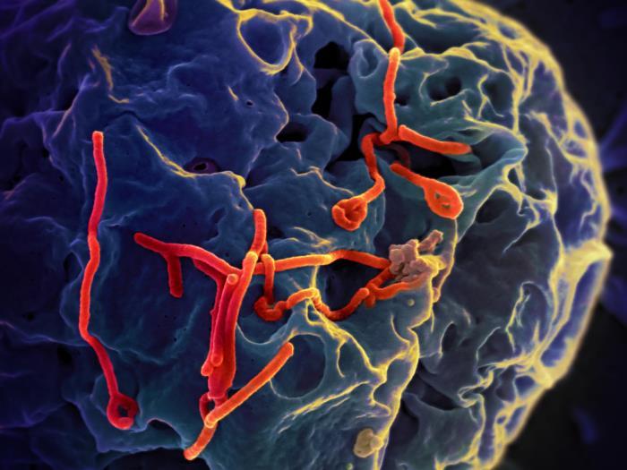 Electron micrograph of Ebola viruses