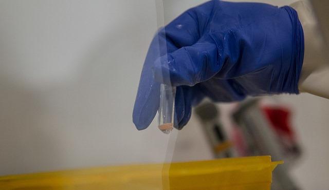 Ebola test lab