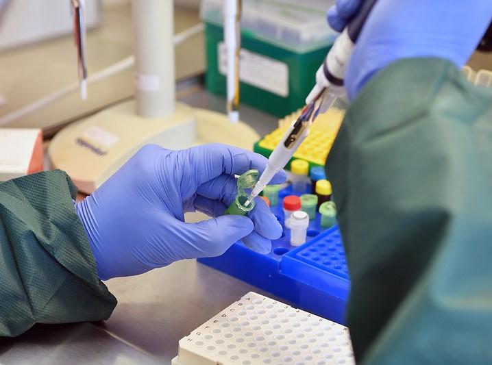 Ebola testing with pipette