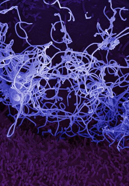 Ebola virus