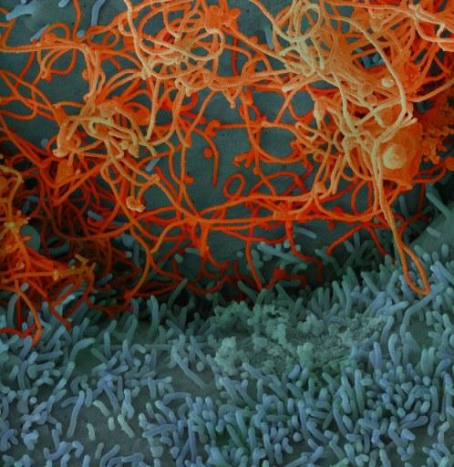 Ebola viruses