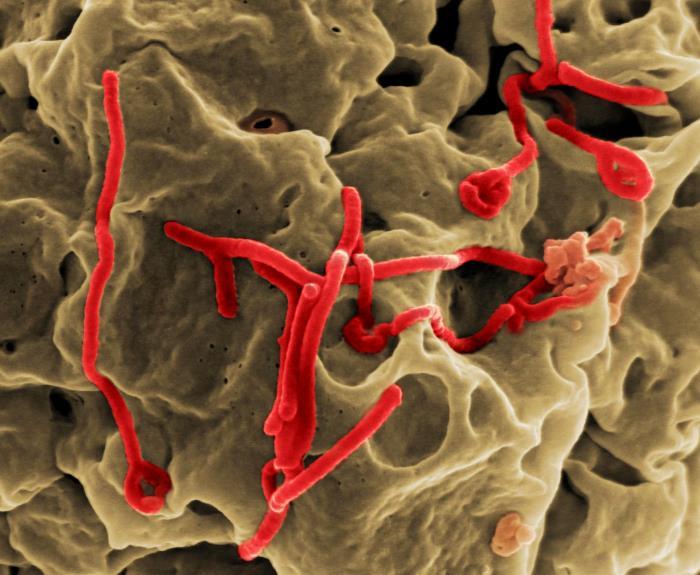 Ebola virus particles