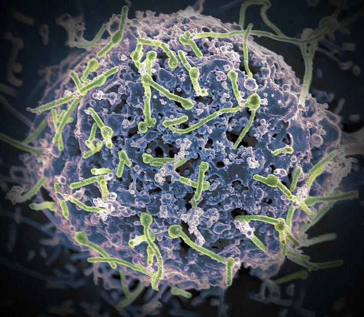 Ebola viruses infecting cell