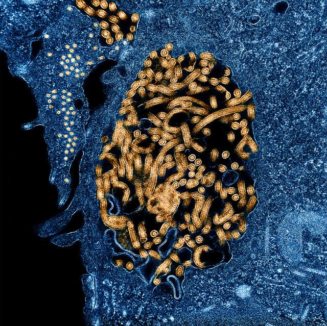 Ebola virus