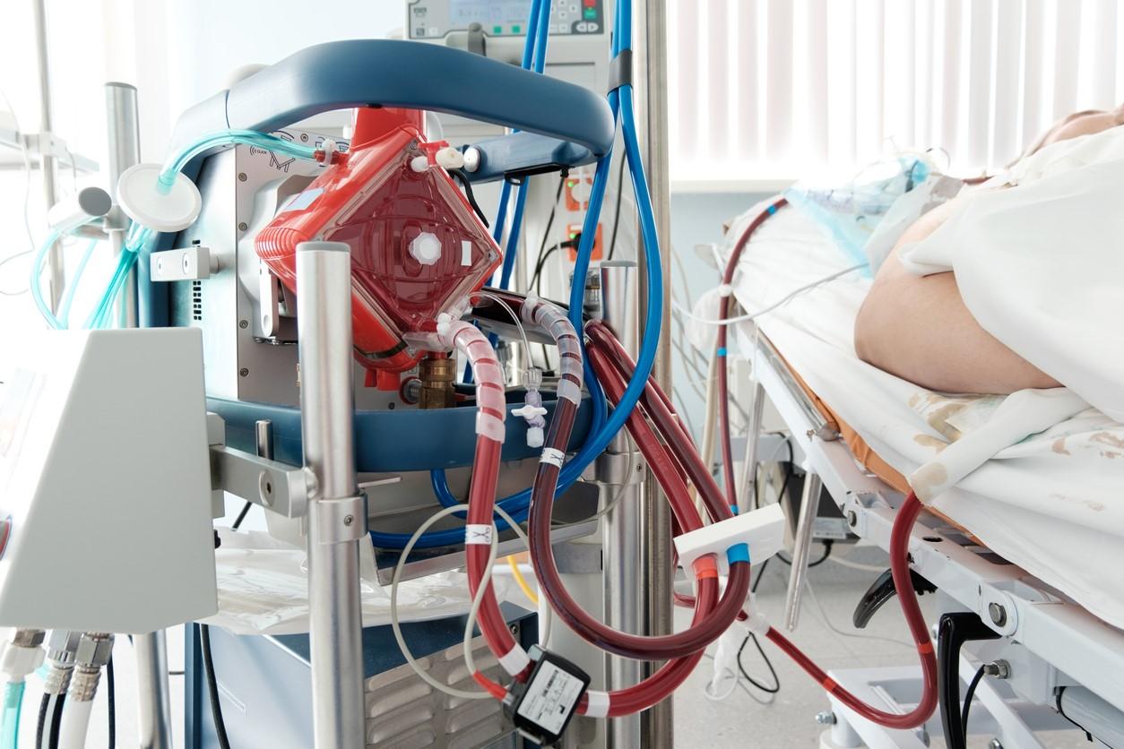 ECMO machine at hospital bedside
