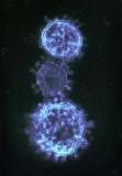 MERS-CoV micrograph