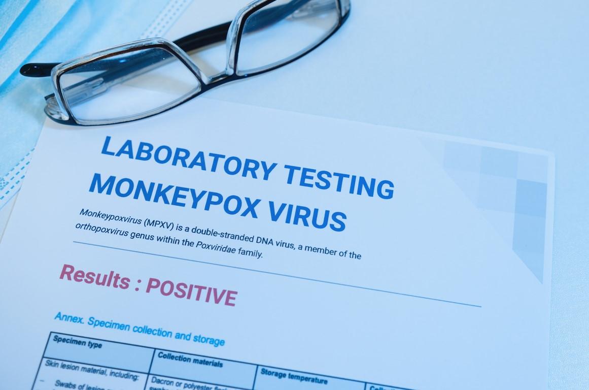 Paperwork showing positive monkeypox test results