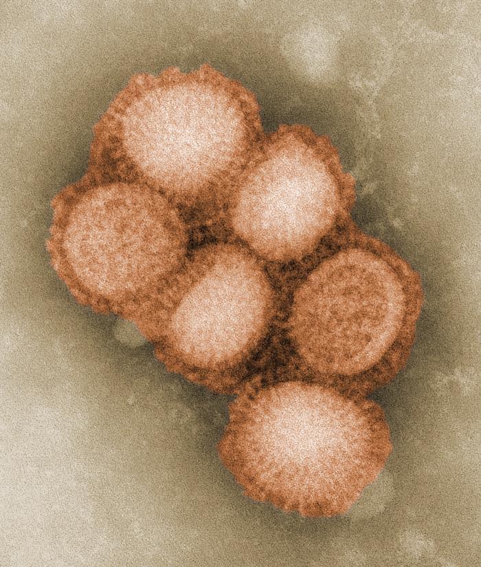 H1N1 virus