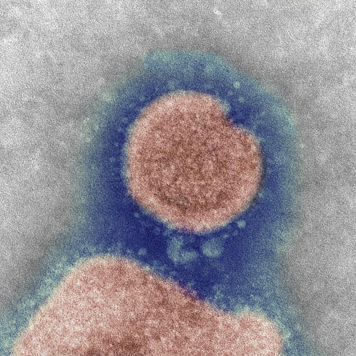 H7N9 micrograph image