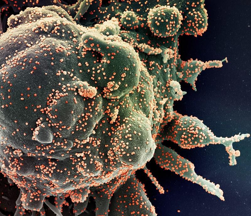 Magnified SARS-CoV-2 COVID-19 virus
