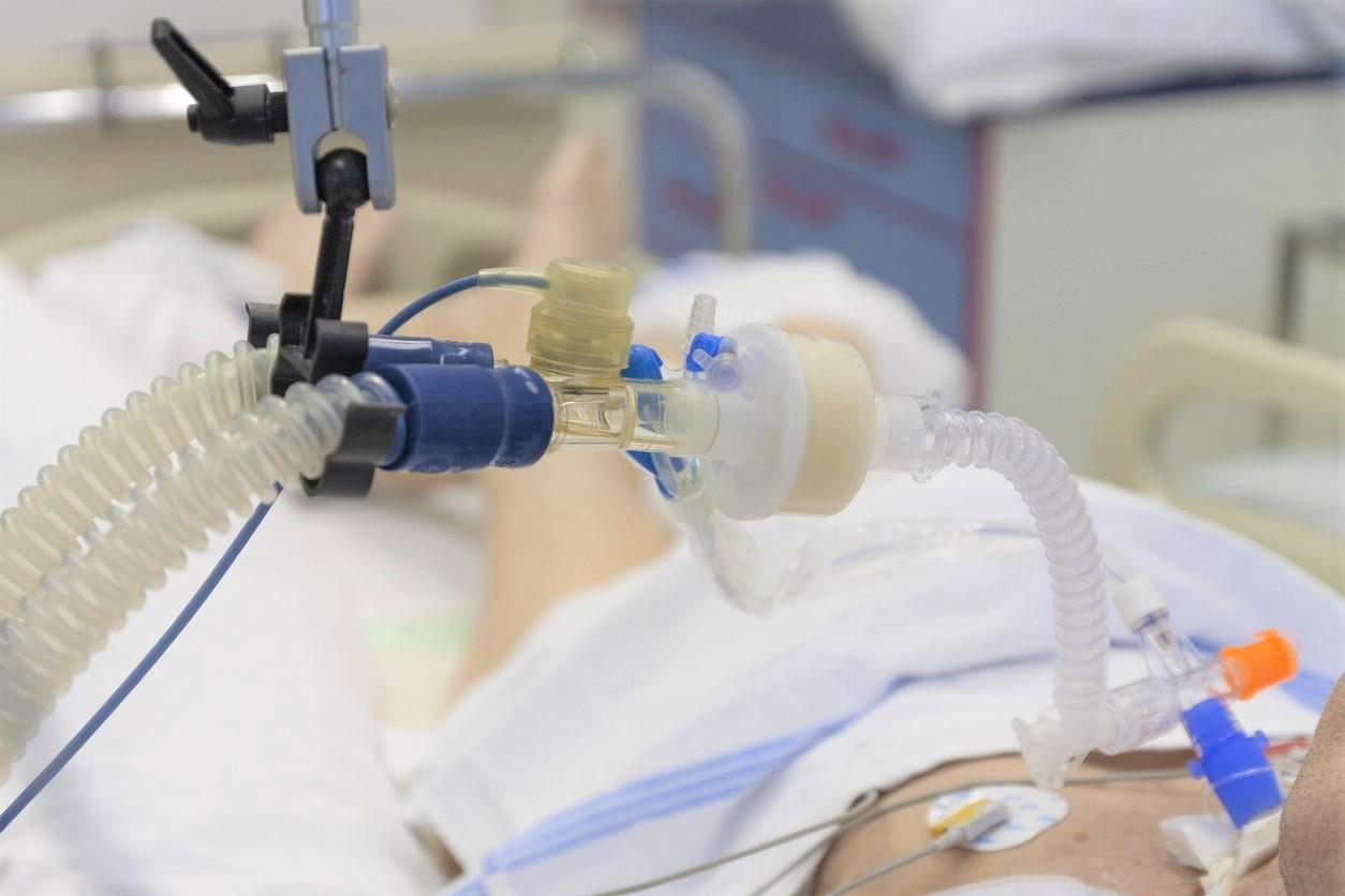 ICU patient on ventilator